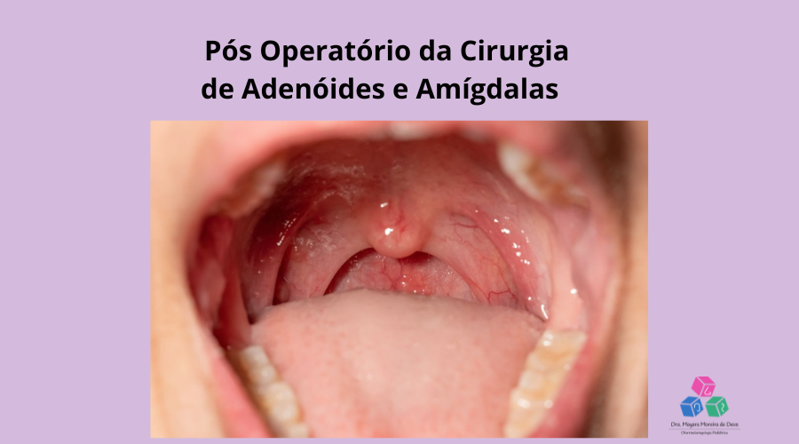 O pós-operatório de adenoide e amígdalas